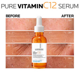 La Roche Posay Pure Vitamin C12 Serum 30ml
