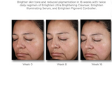 Neostrata Enlighten Pigment Controller Fluid For Dark spots and Uneven skin tone 50ml