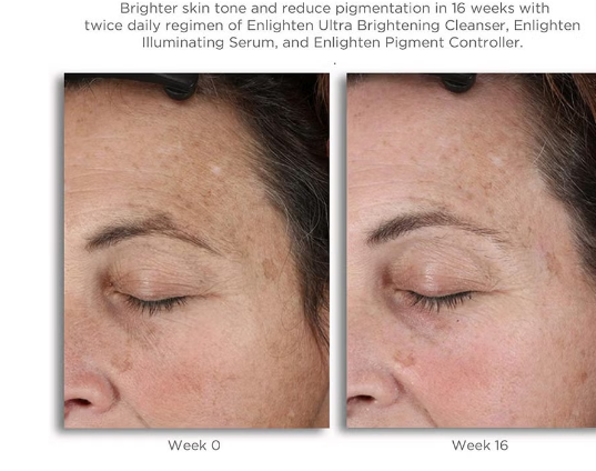 Neostrata Enlighten Pigment Controller Fluid For Dark spots and Uneven skin tone 50ml