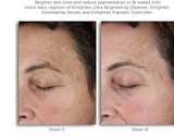 Neostrata Enlighten Pigment Controller Fluid For Dark spots and Uneven skin tone 50ml