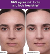 PAULA'S CHOICE (30ml) - CLINICAL 1% Retinol Treatment Cream Peptides, Vitamin C & Licorice Extract Anti-Ageing & Wrinkles 30ml