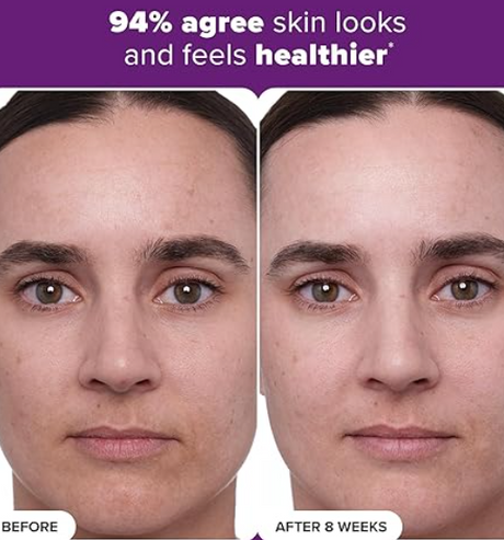 PAULA'S CHOICE (30ml) - CLINICAL 1% Retinol Treatment Cream Peptides, Vitamin C & Licorice Extract Anti-Ageing & Wrinkles 30ml